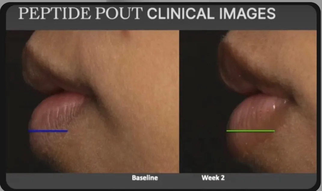 *Preorder* Nu Colour Peptide Pout